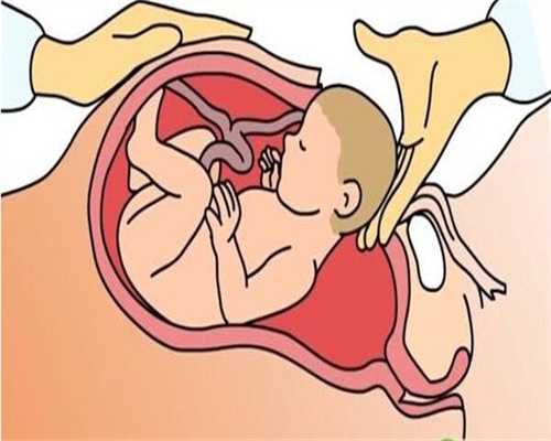 人工授精生男孩经验孕妇肠炎可以吃什么药