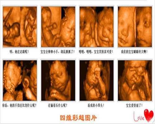 高血压女性孕前需仔细检查_北京助孕辅助生育公