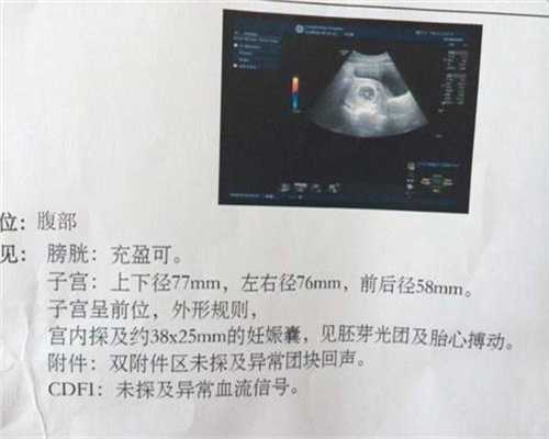 助孕第3周时胎儿的发育图